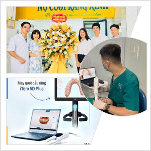 Bàn giao Công nghệ ITero 5D tại Nha Khoa Răng Xinh