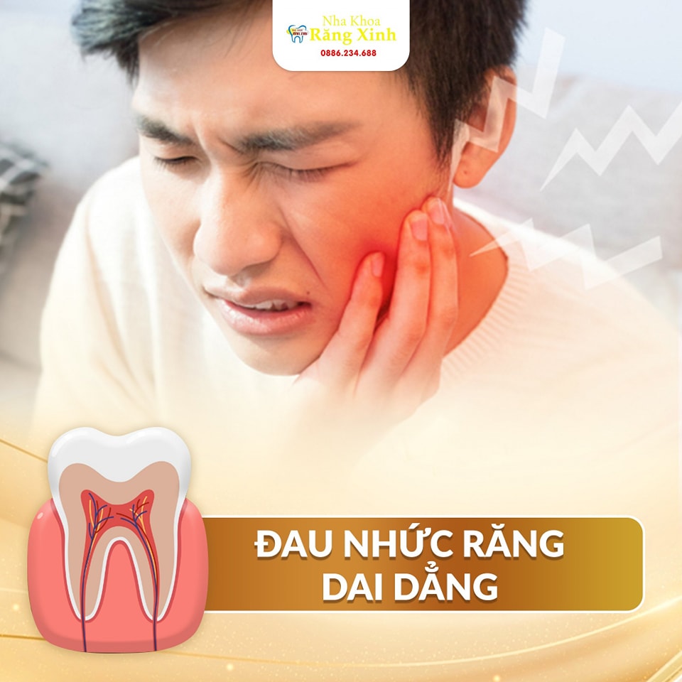 CÁC VẤN ĐỀ PHỔ BIẾN VỀ SỨC KHỎE RĂNG MIỆNG-NGUYÊN NHÂN,PHÒNG NGỪA VÀ ...