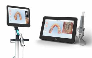 Công nghệ máy quét itero 5D