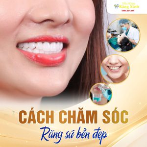 Ảnh minh họa, Cách chăm sóc răng sứ bền đẹp