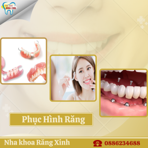 phục hình răng tại nha khoa răng xinh