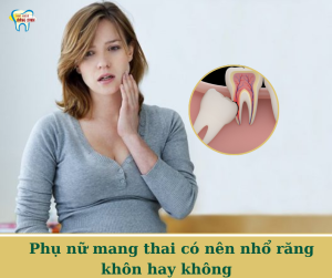 phụ nữ mang thai có nên nhổ răng khôn hay không
