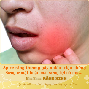 Áp xe răng thường gây nhiều triệu chứng như sưng ở mặt hoặc má, sưng lợi có mũ...