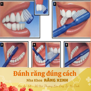 đánh răng đúng cách