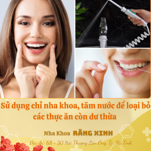 Sử dụng chỉ nha khoa hoặc tăm nước để loại bỏ thức ăn còn dư thừa ở kẻ răng