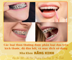 Các loại thun thường được phân loại dựa trên kích thước, độ đàn hồi, và mục đích sử dụng