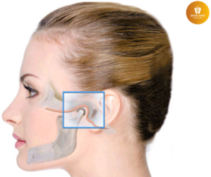 Rối loạn khớp thái dương hàm.