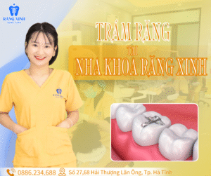 Trám răng tại nha khoa Răng Xinh.