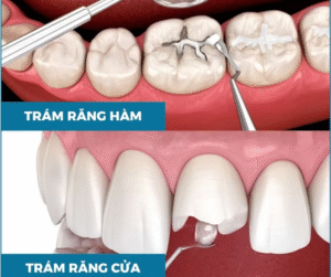 Thời gian thực hiện thực hiện nhanh giúp khách hàng thoải mái và yên tâm .