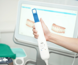 Quét răng 5D bằng máy iTero Element.công nghệ lập kế hoạch điều trị dựa trên mô phỏng kỹ thuật số, mô phỏng kết quả sau điều trị.