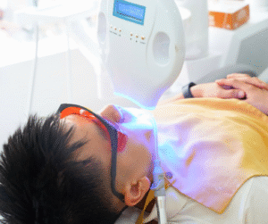 Tại nha khoa Răng Xinh quy trình tẩy trắng răng đươc thực hiện tuần tự theo các bước, đảm bảo hiệu quả và bảo vệ men răng tối đa