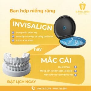 SO SÁNH NIỀNG RĂNG INVISALIGN VÀ NIỀNG RĂNG MẮC CÀI