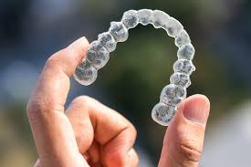 Niềng răng Invisalign – gần như vô hình, thẩm mỹ vượt trội