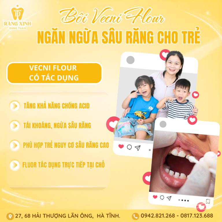 BÔI VECNI FLUOR – NGĂN NGỪA SÂU RĂNG CHO TRẺ NHỎ